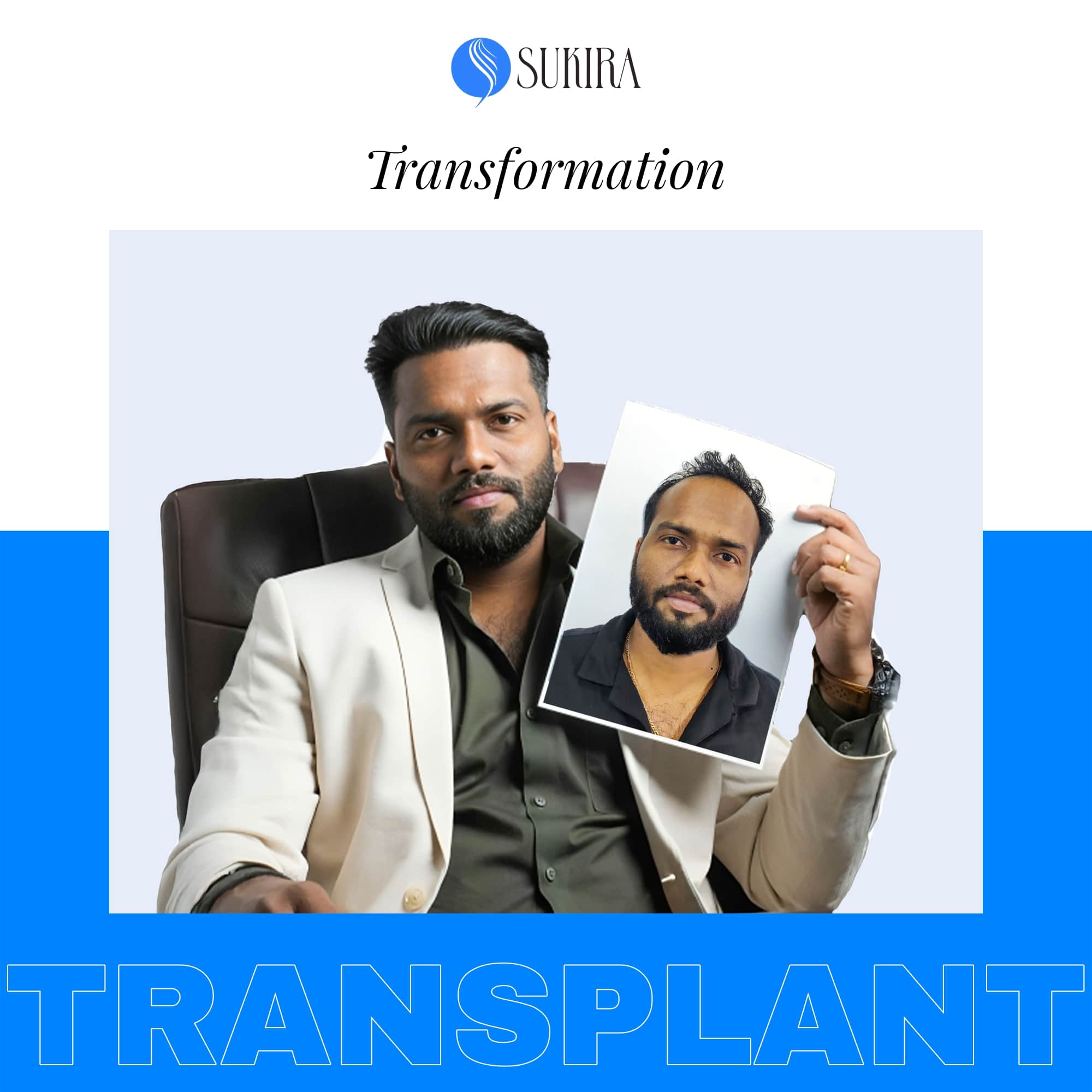 Hair Transplantation ba 7