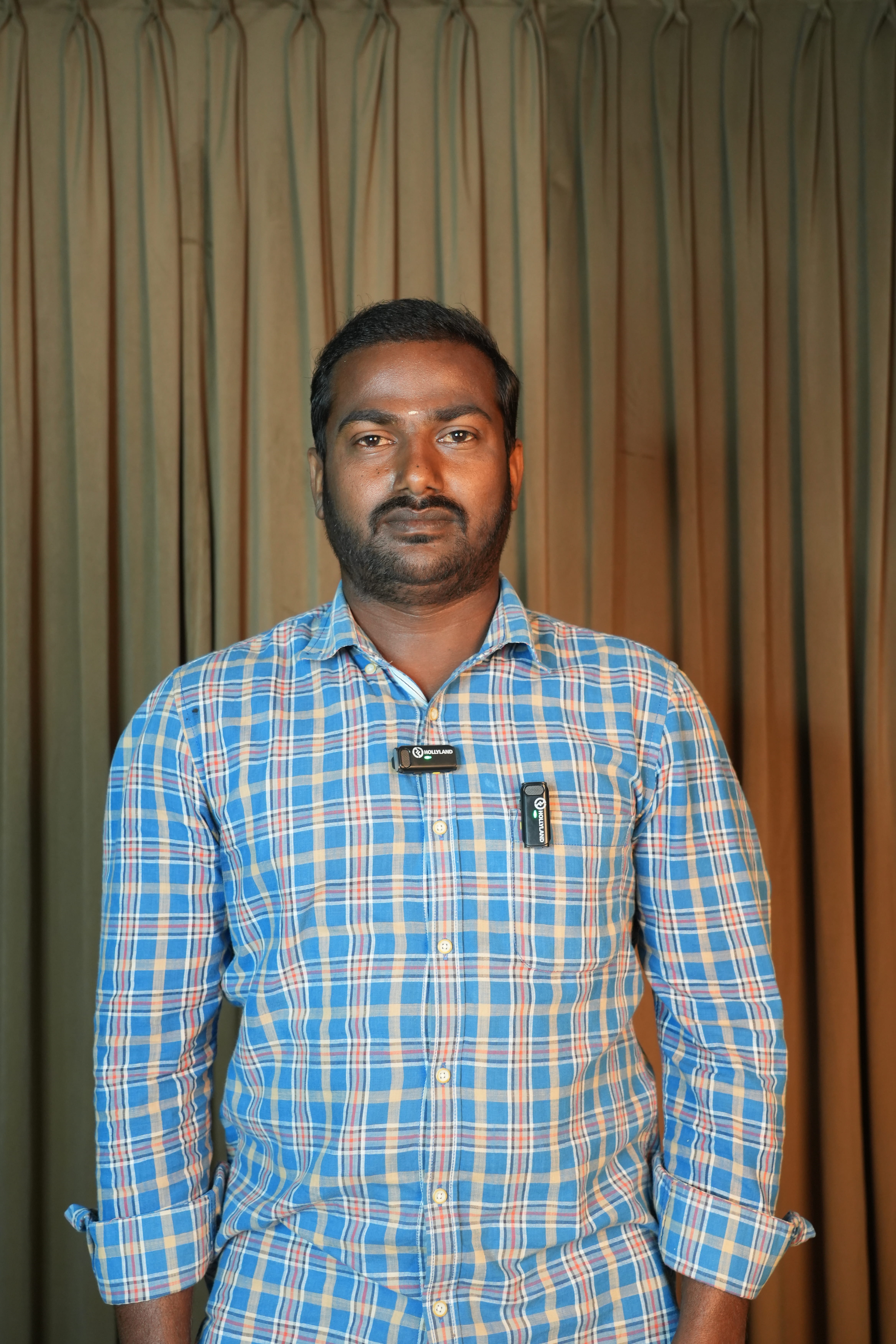 After Hair Transplantation