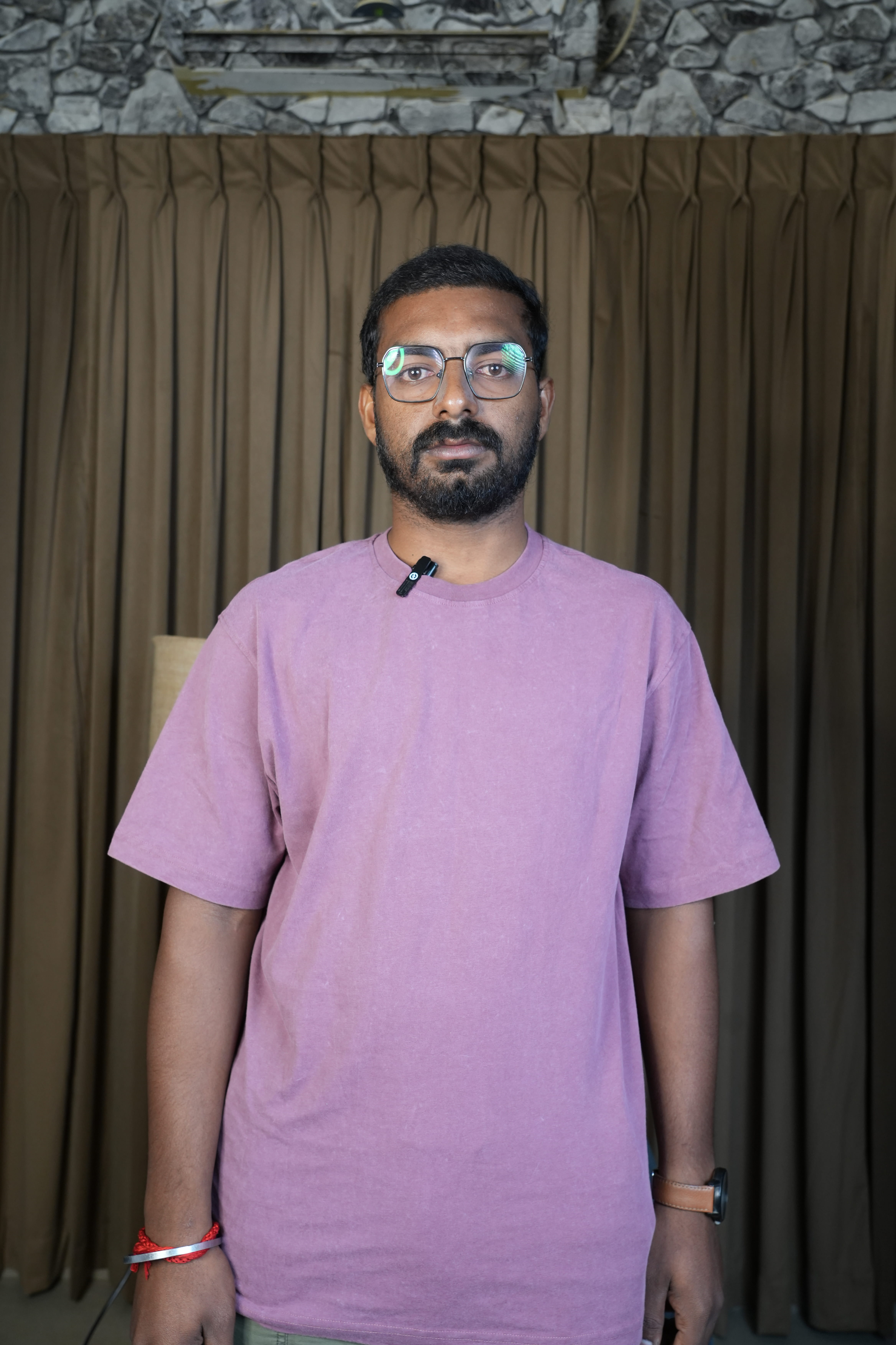 After Beard Transplant